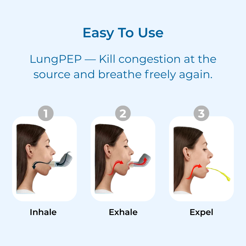 Instant Congestion Removal