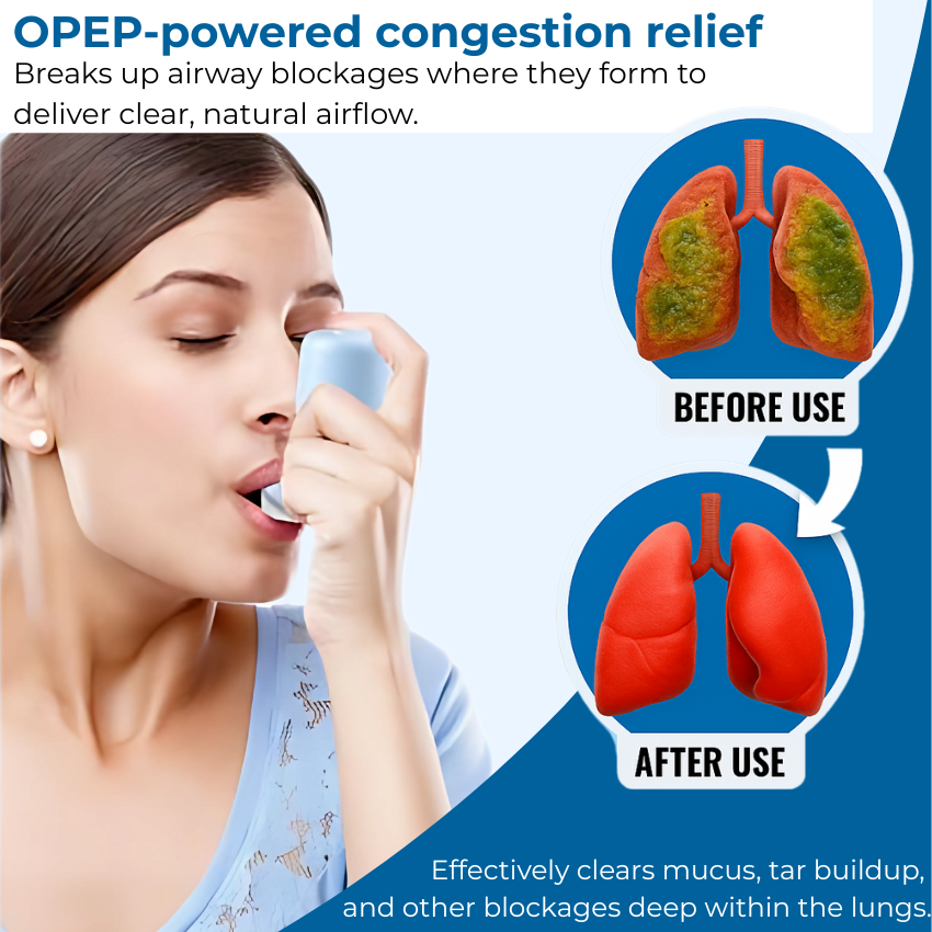 Instant Congestion Removal